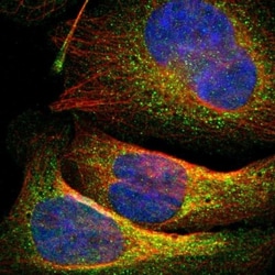 15-PGDH/HPGD Antibody, Novus Biologicals 0.1mL; Unlabeled:Antibodies, Polyclonal