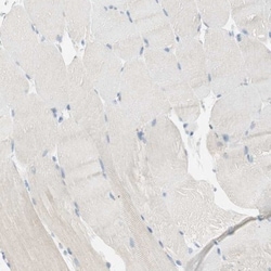 15-PGDH/HPGD Antibody, Novus Biologicals 0.1mL; Unlabeled:Antibodies, Polyclonal