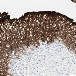 15-PGDH/HPGD Antibody, Novus Biologicals 0.1mL; Unlabeled:Antibodies, Polyclonal