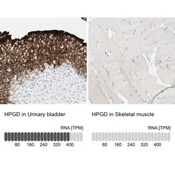 15-PGDH/HPGD Antibody, Novus Biologicals 0.1mL; Unlabeled:Antibodies, Polyclonal