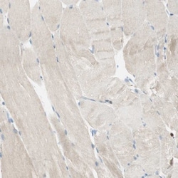 15-PGDH/HPGD Antibody, Novus Biologicals 0.1mL; Unlabeled:Antibodies, Polyclonal