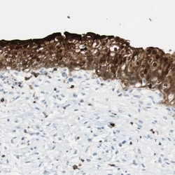 15-PGDH/HPGD Antibody, Novus Biologicals 0.1mL; Unlabeled:Antibodies, Polyclonal
