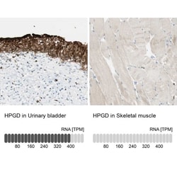 15-PGDH/HPGD Antibody, Novus Biologicals 0.1mL; Unlabeled:Antibodies, Polyclonal