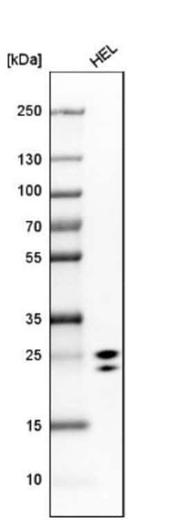 15-PGDH/HPGD Antibody, Novus Biologicals 0.1mL; Unlabeled:Antibodies, Polyclonal