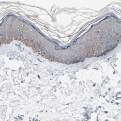 HPRT Antibody, Novus Biologicals 0.1mL; Unlabeled:Antibodies, Polyclonal