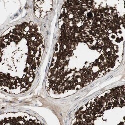 HPRT Antibody, Novus Biologicals 0.1mL; Unlabeled:Antibodies, Polyclonal