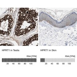 HPRT Antibody, Novus Biologicals 0.1mL; Unlabeled:Antibodies, Polyclonal