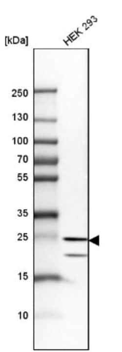 HPRT Antibody, Novus Biologicals 0.1mL; Unlabeled:Antibodies, Polyclonal
