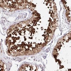 HPS1 Antibody, Novus Biologicals 0.1mL; Unlabeled:Antibodies, Polyclonal