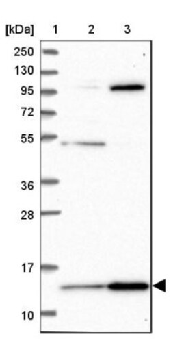 HPSC152 Antibody, Novus Biologicals 0.1mL; Unlabeled:Antibodies, Polyclonal
