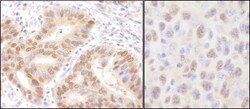 HR6A/UBE2A Antibody, Novus Biologicals 100 &mu;L | Buy Online | Novus Biologicals | Fisher Scientific