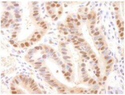 HR6A/UBE2A Antibody, Novus Biologicals 100 &mu;L | Buy Online | Novus Biologicals | Fisher Scientific