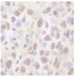 HR6A/UBE2A Antibody, Novus Biologicals 100 &mu;L | Buy Online | Novus Biologicals | Fisher Scientific