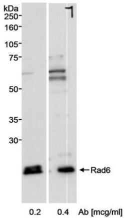 HR6A/UBE2A Antibody, Novus Biologicals 100 &mu;L | Buy Online | Novus Biologicals | Fisher Scientific