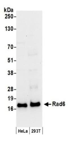 HR6A/UBE2A Antibody, Novus Biologicals 100 &mu;L | Buy Online | Novus Biologicals | Fisher Scientific