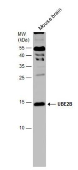 HR6B/UBE2B Antibody, Novus Biologicals 0.1mL; Unlabeled:Antibodies, Polyclonal