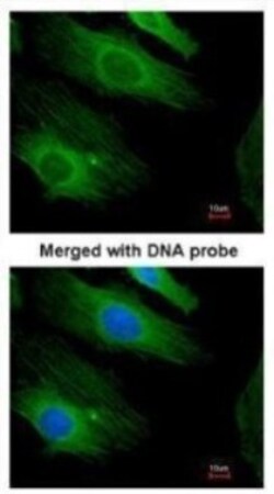 HRAS Antibody, Novus Biologicals 0.1mL:Antibodies, Polyclonal