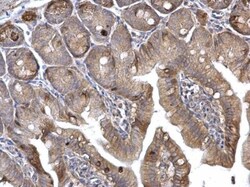 HRAS Antibody, Novus Biologicals 0.1mL:Antibodies, Polyclonal