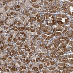 HRAS like suppressor Antibody, Novus Biologicals 25 &mu;L, Unlabeled:Antibodies,