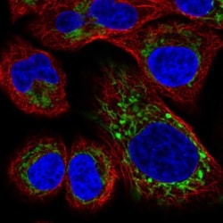 HRASLS2 Antibody, Novus Biologicals 0.1mL; Unlabeled:Antibodies, Polyclonal