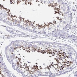 HRASLS2 Antibody, Novus Biologicals 0.1mL; Unlabeled:Antibodies, Polyclonal