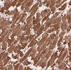 HRC Antibody, Novus Biologicals 25ul | Buy Online | Novus Biologicals | Fisher Scientific