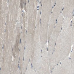 HRD1 Antibody, Novus Biologicals 25 &mu;L; Unlabeled:Antibodies, Polyclonal