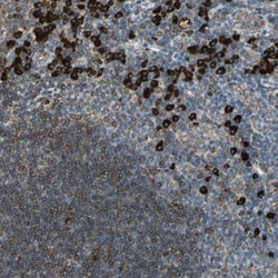 HRD1 Antibody, Novus Biologicals 25 &mu;L; Unlabeled:Antibodies, Polyclonal