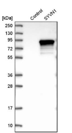 HRD1 Antibody, Novus Biologicals 25 &mu;L; Unlabeled:Antibodies, Polyclonal