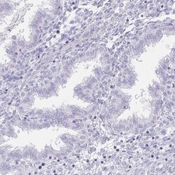 HRP-1/HDGFL1 Antibody, Novus Biologicals:Antibodies:Primary Antibodies