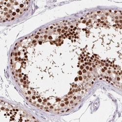 HRP-1/HDGFL1 Antibody, Novus Biologicals:Antibodies:Primary Antibodies