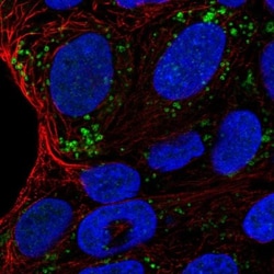 HSD11B2 Antibody, Novus Biologicals 0.1mL; Unlabeled:Antibodies, Polyclonal