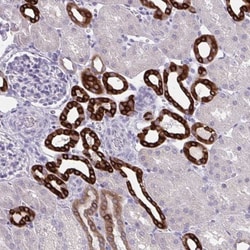 HSD11B2 Antibody, Novus Biologicals 0.1mL; Unlabeled:Antibodies, Polyclonal