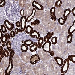 HSD11B2 Antibody, Novus Biologicals 0.1mL; Unlabeled:Antibodies, Polyclonal