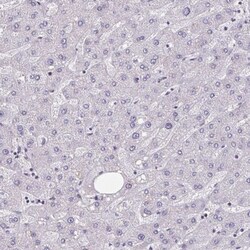HSD11B2 Antibody, Novus Biologicals 0.1mL; Unlabeled:Antibodies, Polyclonal