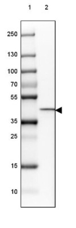 HSD11B2 Antibody, Novus Biologicals 0.1mL; Unlabeled:Antibodies, Polyclonal