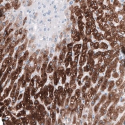HSD17B13 Antibody, Novus Biologicals 0.1mL; Unlabeled:Antibodies, Polyclonal
