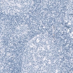 HSD17B13 Antibody, Novus Biologicals 0.1mL; Unlabeled:Antibodies, Polyclonal