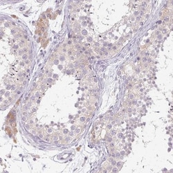 HSD17B3 Antibody, Novus Biologicals 0.1mL; Unlabeled:Antibodies, Polyclonal