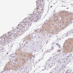 HSD17B3 Antibody, Novus Biologicals 0.1mL; Unlabeled:Antibodies, Polyclonal