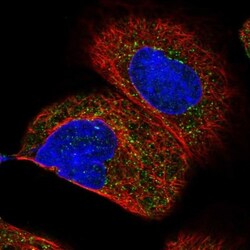 HSD17B4 Antibody, Novus Biologicals 0.1mL; Unlabeled:Antibodies, Polyclonal