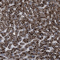 HSD17B4 Antibody, Novus Biologicals 0.1mL; Unlabeled:Antibodies, Polyclonal