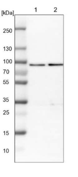 HSD17B4 Antibody, Novus Biologicals 0.1mL; Unlabeled:Antibodies, Polyclonal