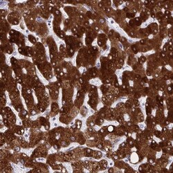 HSD17B6 Antibody, Novus Biologicals 25 &mu;L | Buy Online | Novus Biologicals | Fisher Scientific