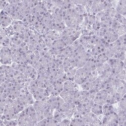 HSD17B6 Antibody, Novus Biologicals 25 &mu;L | Buy Online | Novus Biologicals | Fisher Scientific