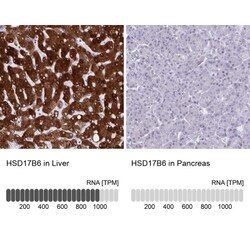 HSD17B6 Antibody, Novus Biologicals 25 &mu;L | Buy Online | Novus Biologicals | Fisher Scientific