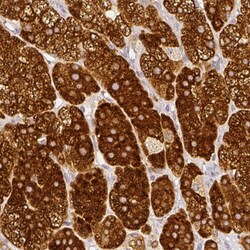 HSD3B1 Antibody, Novus Biologicals 25 &mu;L | Buy Online | Novus Biologicals | Fisher Scientific