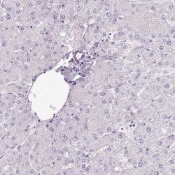 HSD5 Antibody, Novus Biologicals:Antibodies:Primary Antibodies