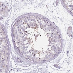 HSD5 Antibody, Novus Biologicals:Antibodies:Primary Antibodies