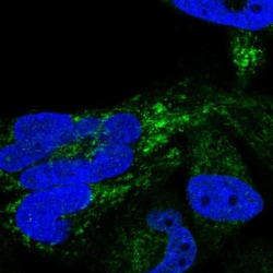 HSDL2 Antibody, Novus Biologicals 0.1mL; Unlabeled:Antibodies, Polyclonal
